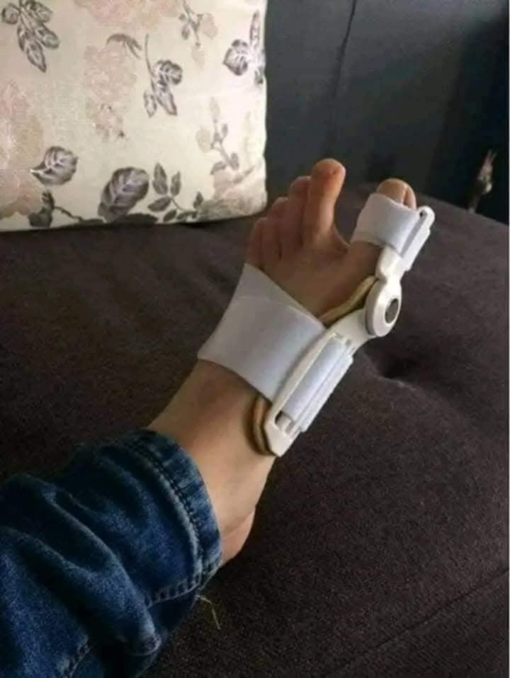 مصحح ابهام القدم